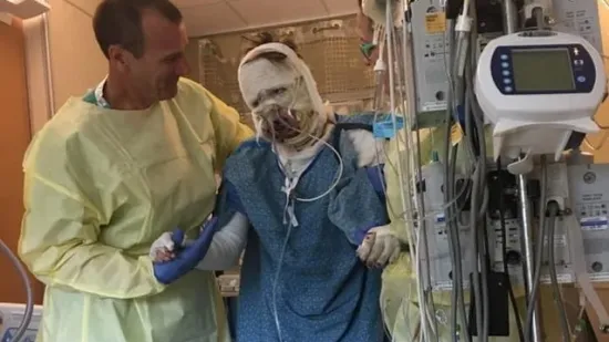 Prije šest godina je teško stradala u eksploziji plina, ljudi se ne mogu načuditi kako danas izgleda
